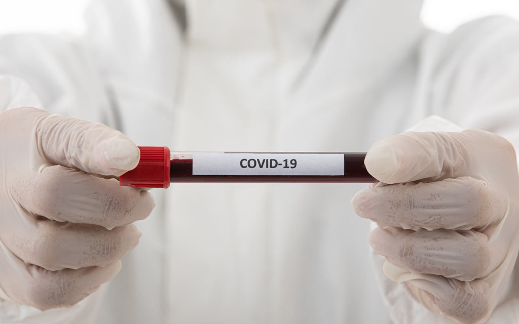 Diferencias del concurso voluntario y necesario: COVID 19